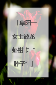 阜阳一女士被龙虾钳卡“脖子”